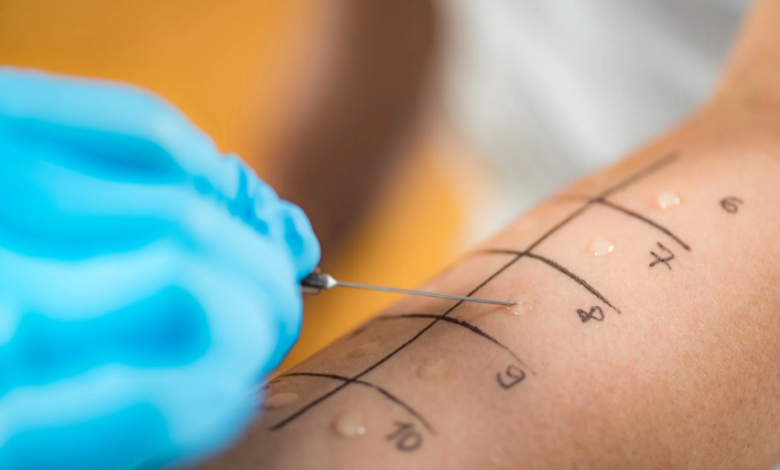 Food Intolerance Tests Explained: What to Expect and How They Help