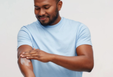 Why I Always Pack Anti-Itch Cream for Bug Bites When Camping