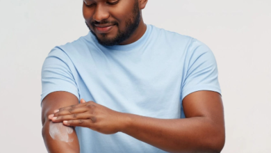 Why I Always Pack Anti-Itch Cream for Bug Bites When Camping