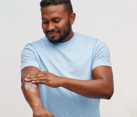 Why I Always Pack Anti-Itch Cream for Bug Bites When Camping