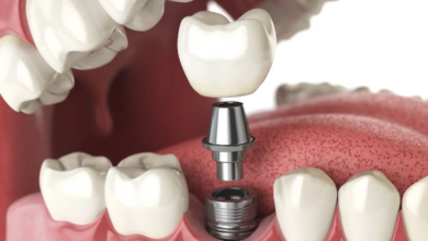 5 Ways Periodontics And Implant Dentistry Restore Healthy Smiles
