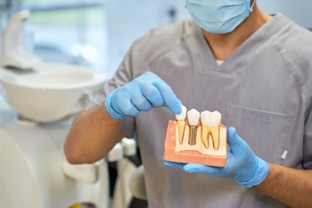 How Cosmetic Dentistry Enhances The Aesthetics Of Implants