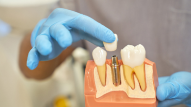 4 Innovations Shaping The Future Of Implant Dentistry