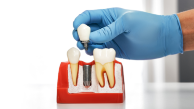Why More Adults Are Turning To Dental Implants For Tooth Replacement