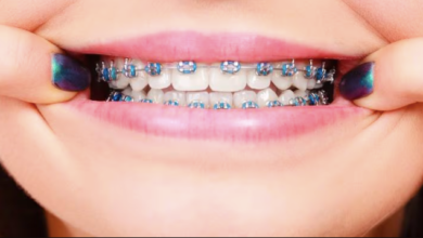 6 Tips For Maintaining Gum Health During Orthodontic Treatment
