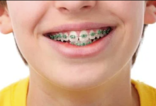 Why Orthodontic Treatment Is Becoming More Accessible For Kids