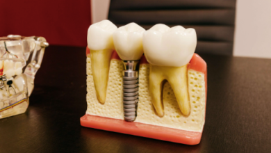 3 Questions To Ask Before Getting Dental Implants
