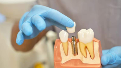 How Oral Surgeons Personalize Implant Procedures For Each Patient
