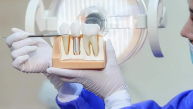 Why Implant Dentistry Is The Gold Standard For Tooth Replacement