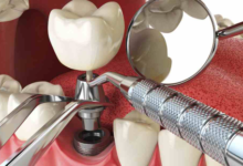 3 Ways Technology Improves The Accuracy Of Dental Diagnoses