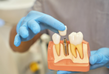 6 Comfort Options Now Available In General Dentistry Practices