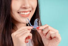 Why Retainers Are Essential After Orthodontic Treatment