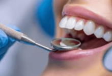 7 Common Signs You Need A Professional Dental Cleaning