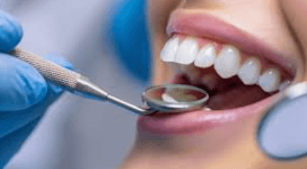 7 Common Signs You Need A Professional Dental Cleaning